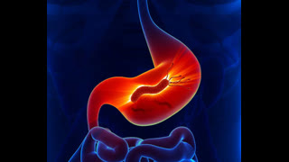 Can you diagnose this case of epigastric fullness ?