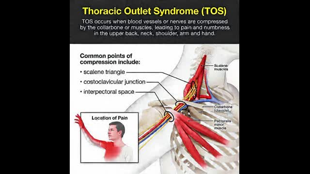 TOS_Board_Review_Complete