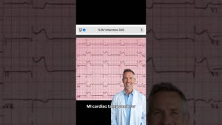 Sudden Chest pain with hypotension